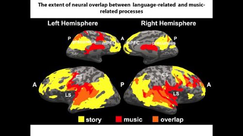 The extent of neural overlap between language-related and music-related processes